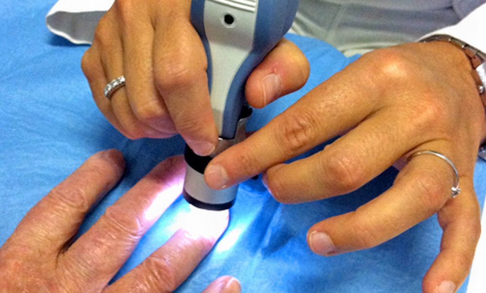 Ragazzo di Taggia deve fare la capillaroscopia, ma l’apparecchio diagnostico di Savona si è rotto e non ce ne son altri in zona