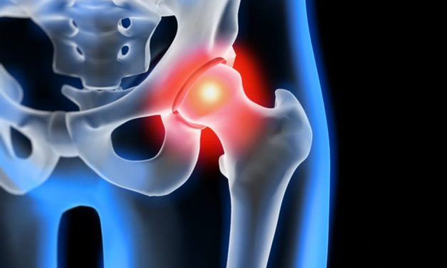 Soffrire di anca, quali diritti? Ce lo spiega il Patronato Acli di Alessandria