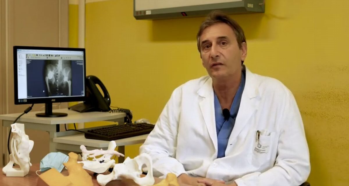 Ad Alessandria una donna torna a camminare con protesi personalizzata grazie al dotto Schiraldi